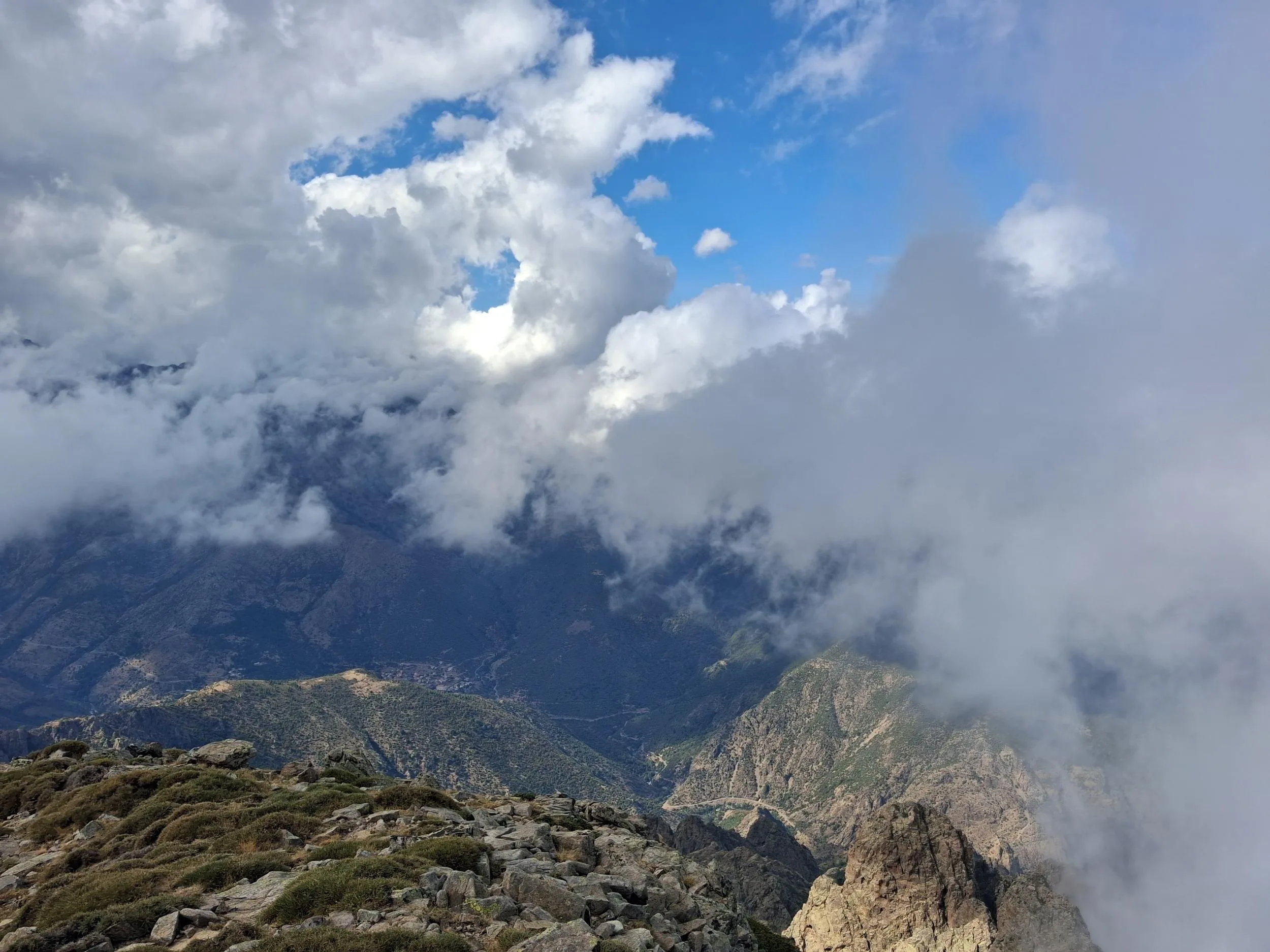 Vue de la dent